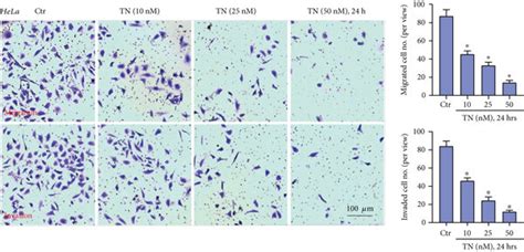 Triptonide Inhibits Human Cervical Cancer Cell Migration And Invasion Download Scientific