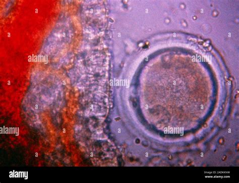 Light Micrograph Of A Human Ovum In The Fallopian Tube The Ovum Or