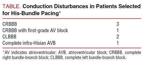 Permanent His Bundle Pacing In Patients With Infra Hisian