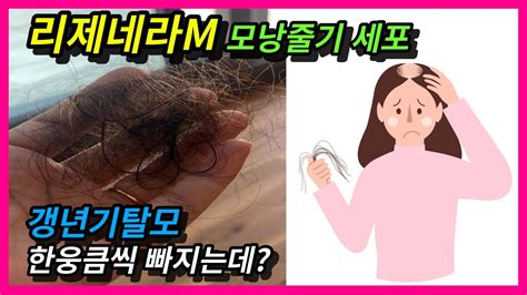 리제네라m 모낭줄기세포 갱년기탈모 한웅큼씩 빠지는데 어떡하죠 Youtube