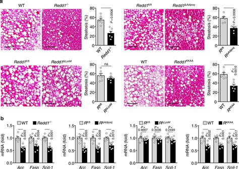 Global Or Adipocyte Specific Loss Of Redd Prevents Hfd Induced Hepatic