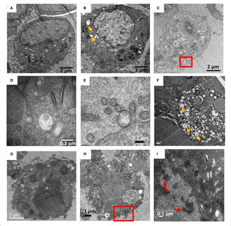 HTNV And ANDV Infection Of Vero E6 On 7 And 9 Dpi A E Are HTNV