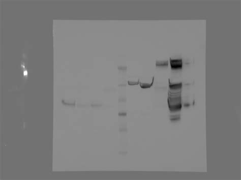 Western Blot multiple bands visualisation? | ResearchGate