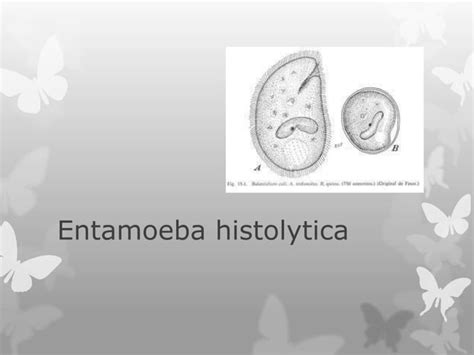 13 Enfermedades Parasitarias Ppt