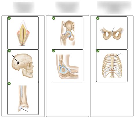 Joints Diagram Quizlet