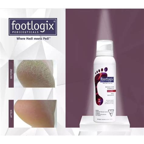 Ready Stock Footlogix Rough Skin Formula Shopee Malaysia