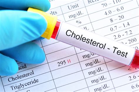 5 plantes médicinales pour lutter contre le cholestérol La Santé Au