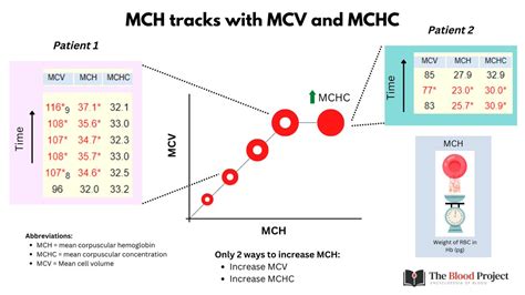 William Aird On Twitter 1 3 FOCUS ON MCHC NOT MCH When Choosing