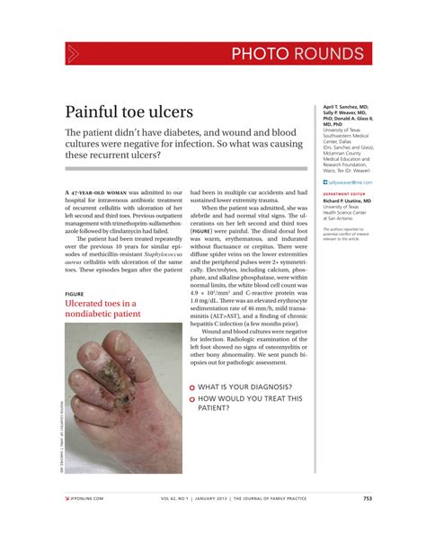 Pdf Painful Toe Ulcers