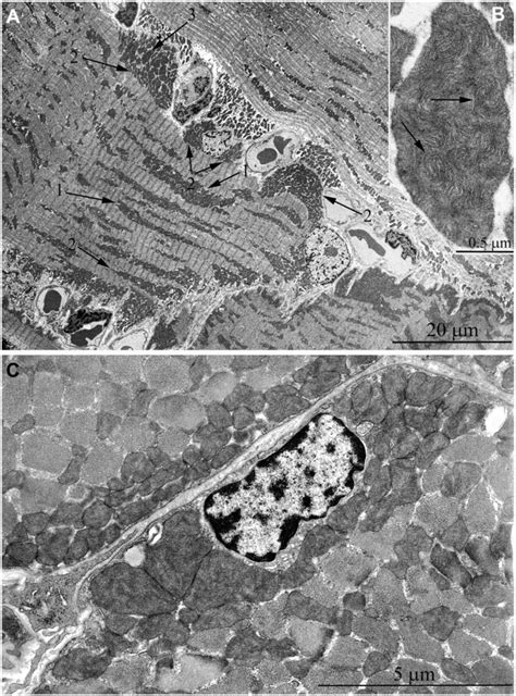 Ultrastructure Of Mitochondria In Skeletal Muscle Of Year Old Naked