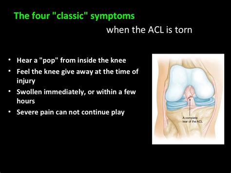 Anterior Cruciate Ligament Injury