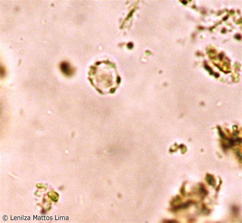 รายการ 98 ภาพ Blastocystis Hominis การ รักษา ความละเอียด 2k 4k