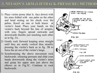 Artificial respiration method | PPT