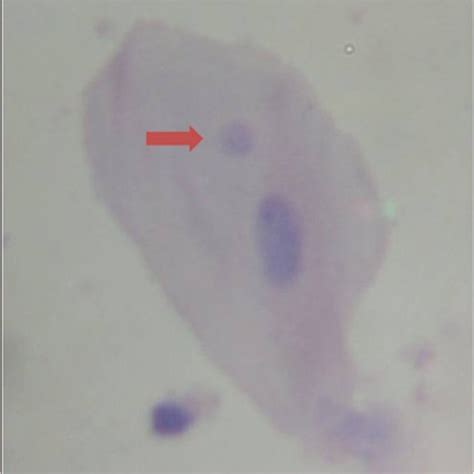 Photomicrography Of Exfoliated Buccal Cell Showing The Presence Of