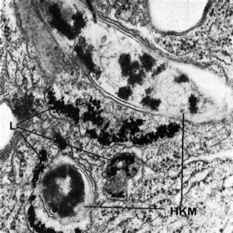 B Electron Micrograph Of Ultrathin Section Of Mouse Peritoneal