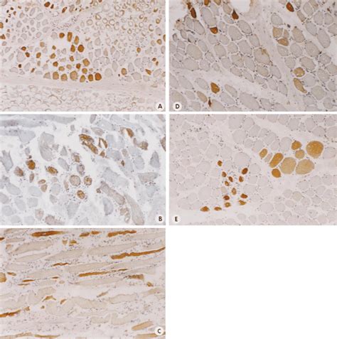 Immunohistochemistry Of DMD Skeletal Muscle Each Panel Represents