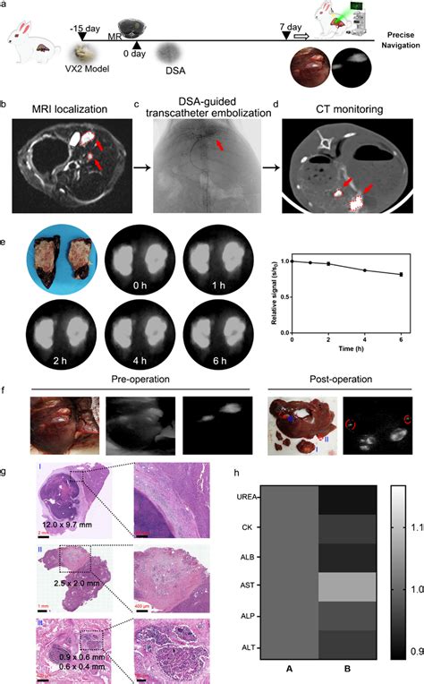 The Evaluation Of Fluorescence Guided Surgical Navigation Of Shift