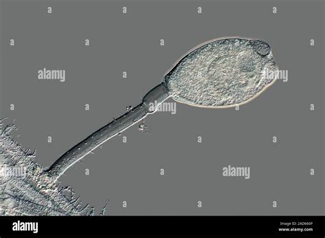 Vorticella Protozoa Differential Interference Contrast DIC Light