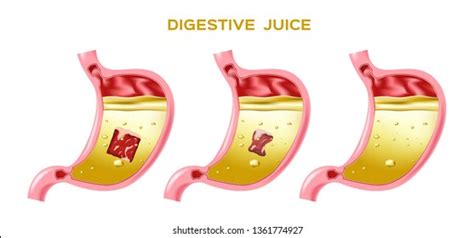 377 The gastric juice in the stomach Images, Stock Photos & Vectors ...