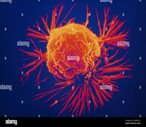 False Colour Scanning Electron Micrograph Sem Of A Single Cancer Cell