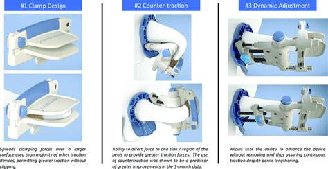 Figure demonstrating key differentiators from other traction devices ...