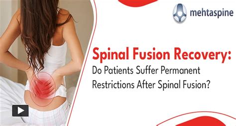 Ppt Spinal Fusion Recovery Your Guide To A Healthy Back Mehta Spine Powerpoint Presentation