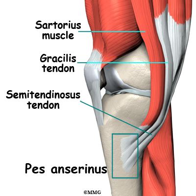 Pes Anserine Bursitis of the Knee | eOrthopod.com