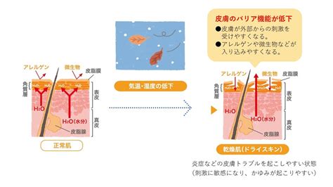 『乾燥肌（ドライスキン）』『乾皮症』の原因・症状・治療法【症例画像】｜田辺三菱製薬｜ヒフノコトサイト