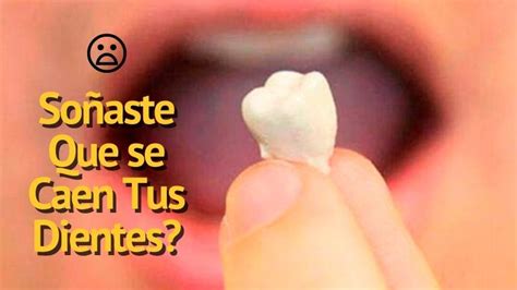 Que Significa Soñar Que Se Te Caen los Dientes Interpretaciones