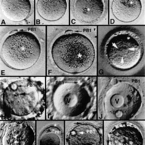 Normal And Dysmorphic Oocytes A B Normal Appearing Oocytes With Download Scientific