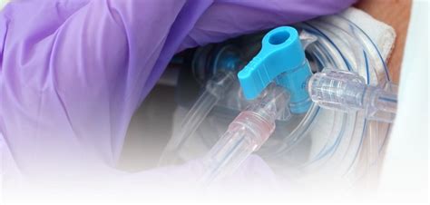 catheter placement services lyme mexico clinic