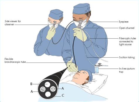 Bronchoscopy Assisting Nurse Key