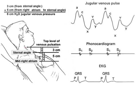 Jugular vein, internal and external jugular vein anatomy, location ...