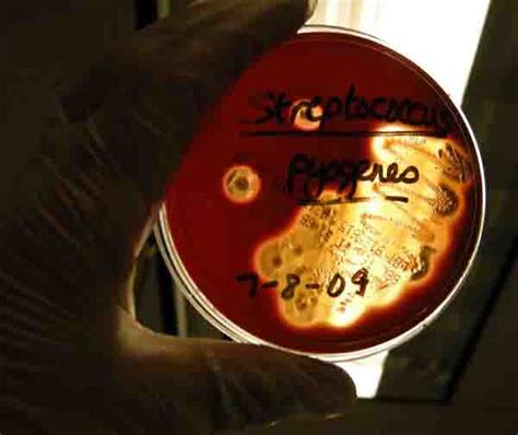 Blood Agar Bacterial Growth Medium