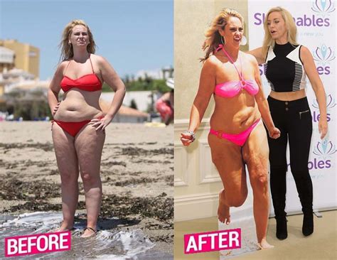 Weight Loss Stories Of Celebrity Before And After Photos