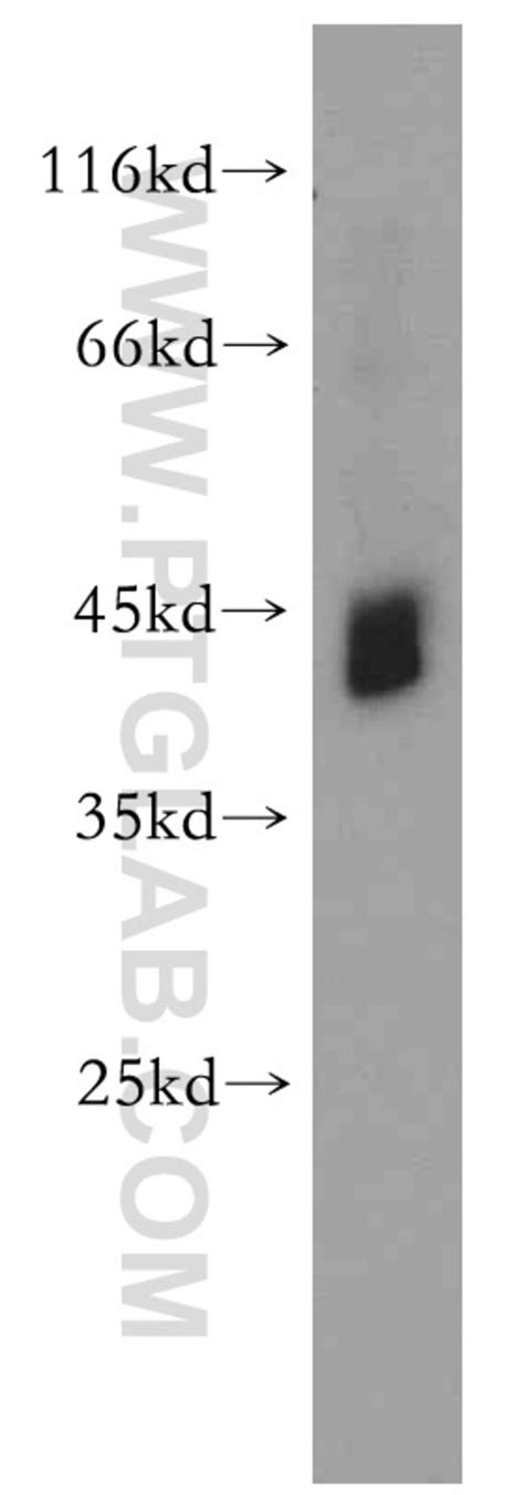 RNF150 Rabbit anti Human Mouse Rat Polyclonal Proteintech 150 μL