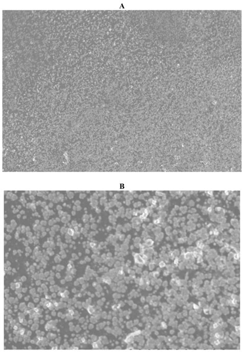 Scanning Electron Photomicrographs From The Posterior Surface Of The