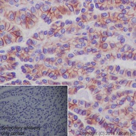 Recombinant Anti-TSH Receptor/TSH-R antibody [EPR19751] (ab218108) | Abcam