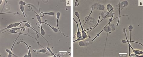 Phase Contrast Microscopy Of Bovine Sperm Intact And Decondensed A