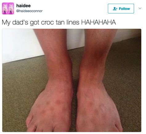 People Are Sharing Their Ungodly Croc Tans And I M Lovin It