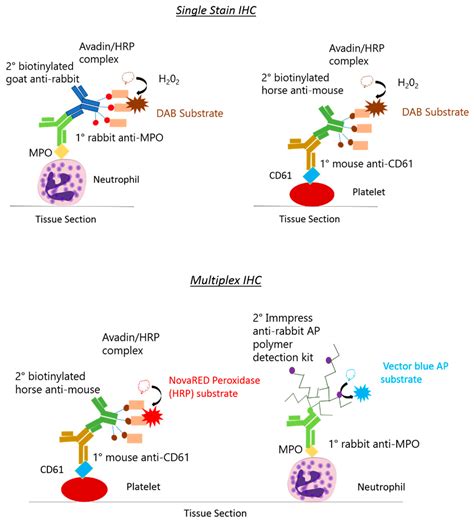 MPs | Free Full-Text | Single and Multiplex Immunohistochemistry to ... 