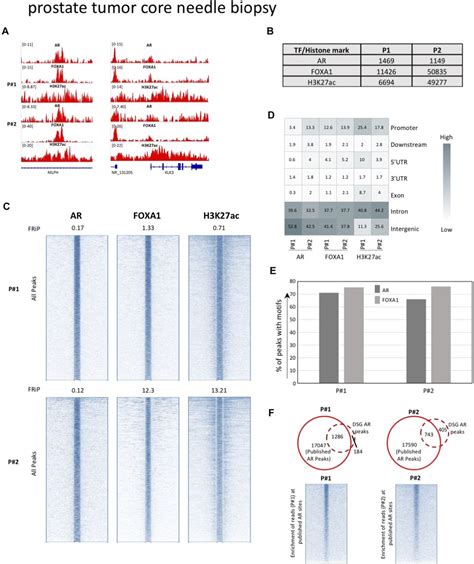 Optimized Chip Seq Method Facilitates Transcription Factor Profiling In