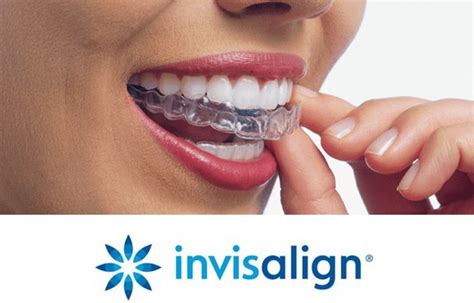 5 Best Reasons To Get Invisalign As An Adult In Nycdr Jacquie