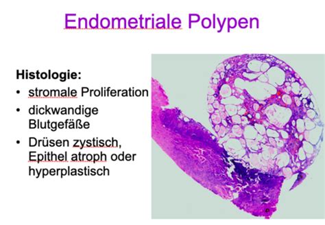 Patho Uterus Karteikarten Quizlet