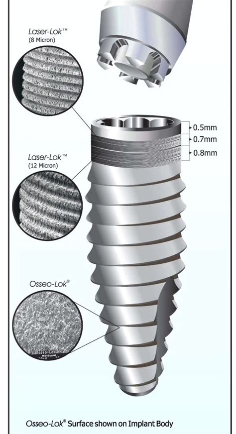 Dental Implant Biohorizons Bio Lok Silhouette Ic Laser Lok