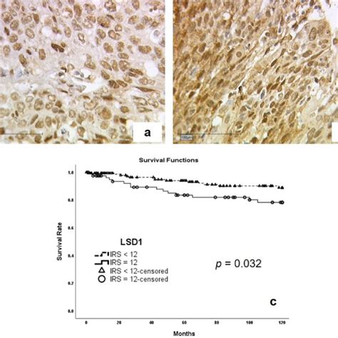 Illustration Of Survival Analysis Cervical Cancer Tissue Stained With Download Scientific