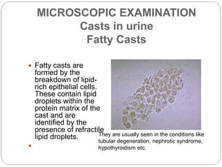 Fat Droplets In Urine