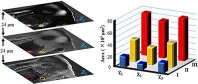 Label Free Identification Of Human Glioma Xenograft Of Mouse Brain With