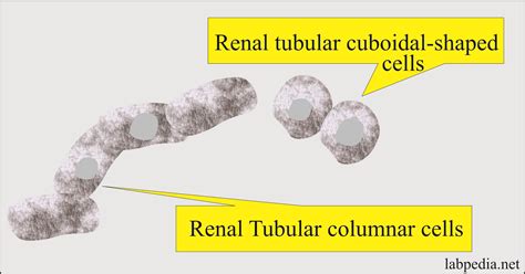 Urine Microscopic Examination And Interpretations