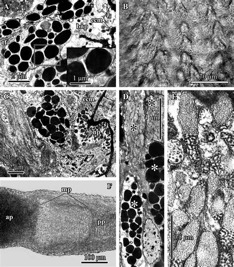 Transmission Electron Micrographs Of The Transverse Sections Of The